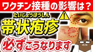 【危険】知らないと後悔する..急増している「帯状疱疹」の超意外な危険サイン。ワクチン接種の影響は?なぜ増加しているのか。恐ろしい「帯状疱疹の後遺症」とは。予防法はあるのか。医師が完全解説。