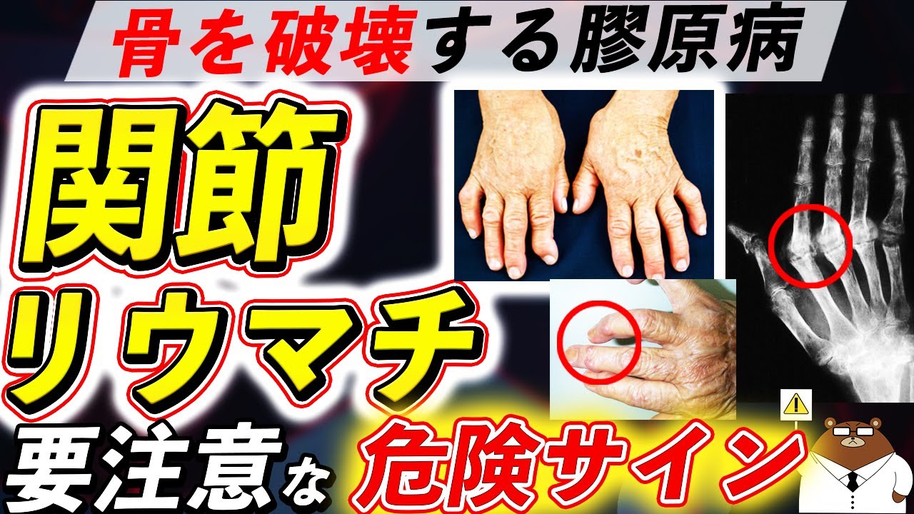 サムネ