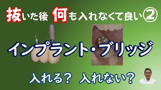 インプラント・ブリッジ、入れる？入れない？