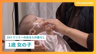 ドキュメンタリー｜18トリソミーのある人の暮らし「1歳 女の子」