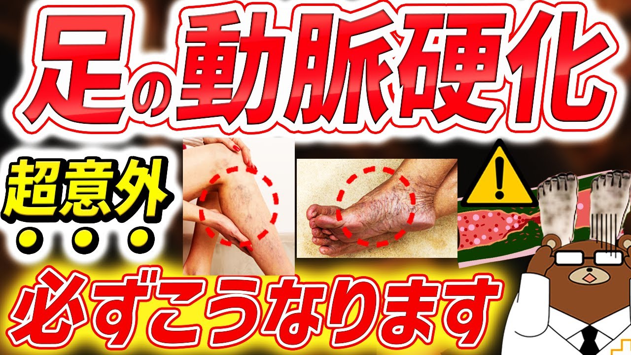 サムネ