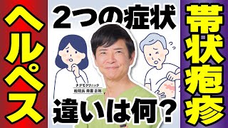 【放置厳禁】その症状は“ヘルペス”?“帯状疱疹”?知っておくべき違いと見分け方を徹底解説(ワクチン・治し方・健康・サイトカイン・ナグモクリニック・予防医療)