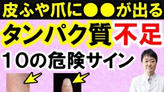 【放置禁止】見逃すと後悔する「タンパク質不足」が起こす１０の変化と症状とその末路　医師が解説